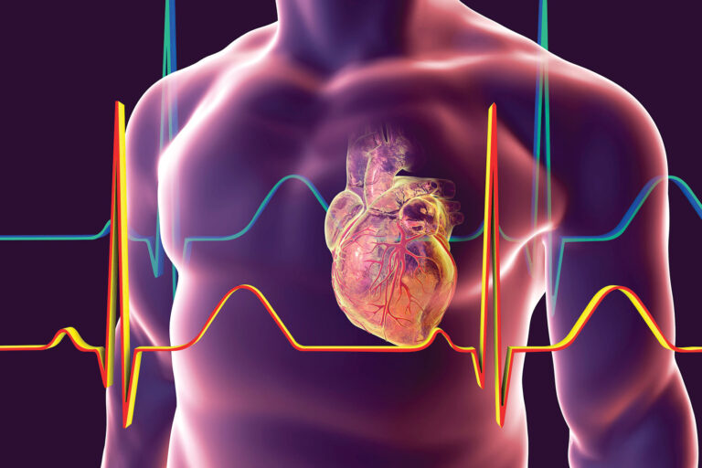 Cardiology quiz