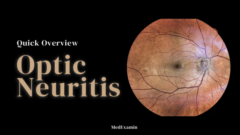 Optic neuritis