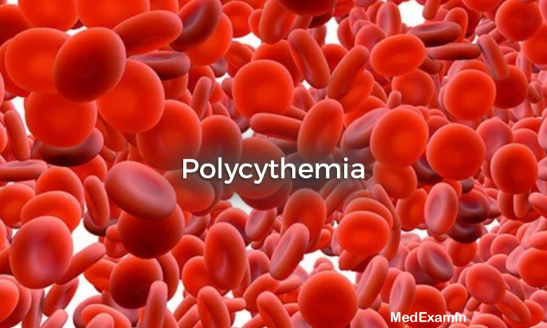 Polycythemia