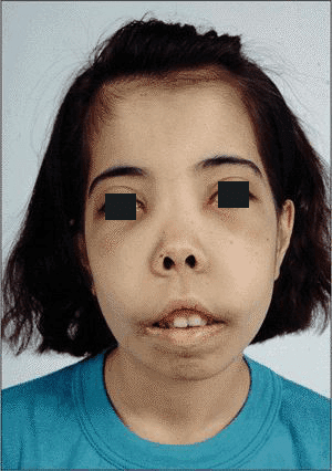 Thalassemia
