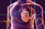 Cardiology quiz